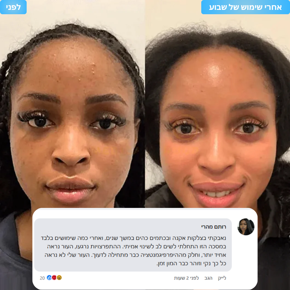 FixedGlow - מסכת קולוגן האולטימטיבית